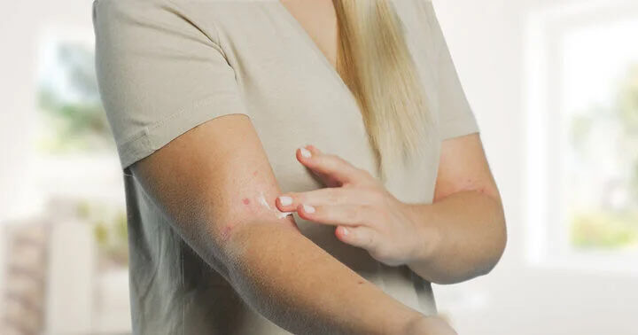 Vanliga orsaker till extremt torr hud